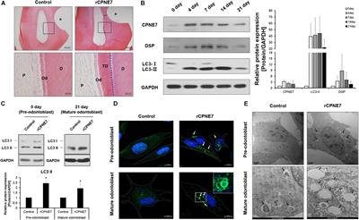 CPNE7-Induced Autophagy Restores the Physiological Function of Mature Odontoblasts